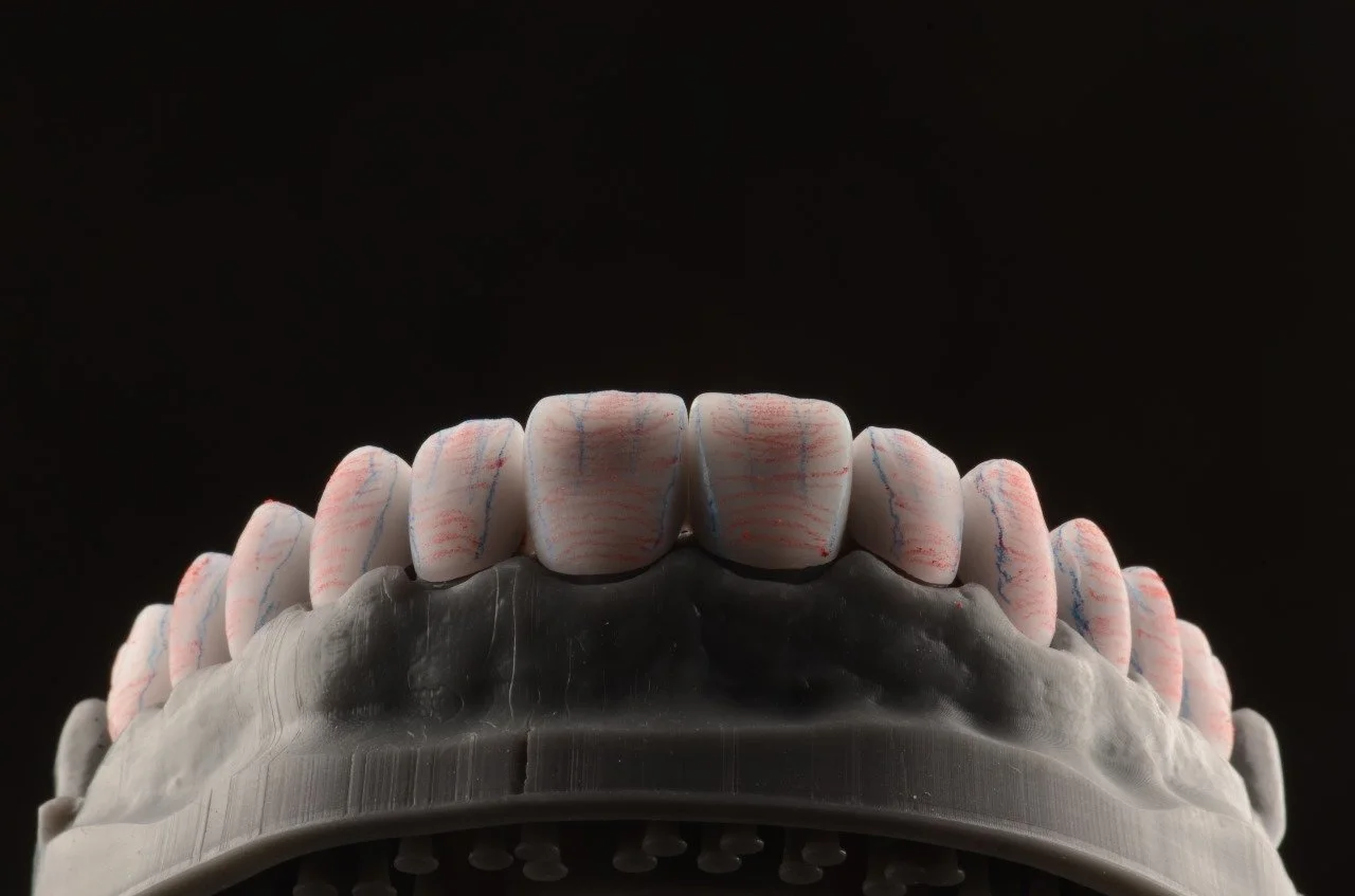 Digital Smile Design in San Antonio, TX | M.I. Dental Designs